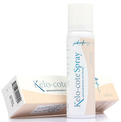 芭克硅凝胶喷剂招商代理 100ml