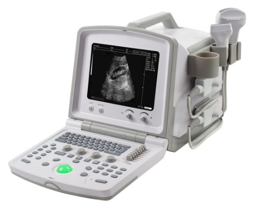 WELLD全数字超声诊断系统招商代理 威尔德医疗