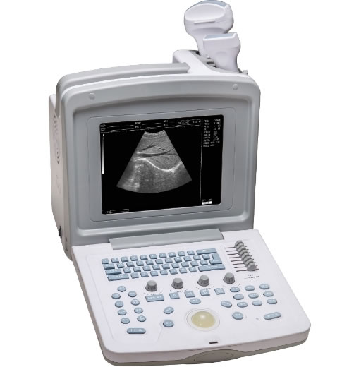 WELLD全数字超声诊断系统招商代理 WED-180 深圳市威尔德